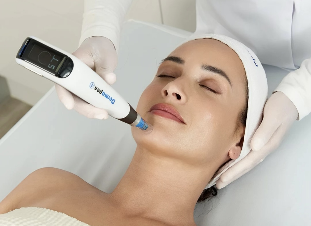 Dermapen Microneedling